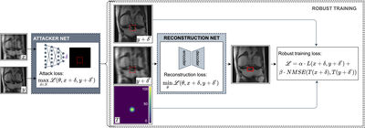 Adversarial Robust Training of Deep Learning MRI Reconstruction Models cover file