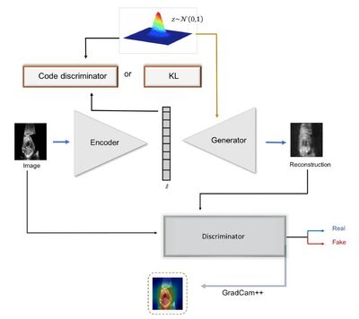 Learning normal appearance for fetal anomaly screening: Application to the unsupervised detection of Hypoplastic Left Heart Syndrome cover file