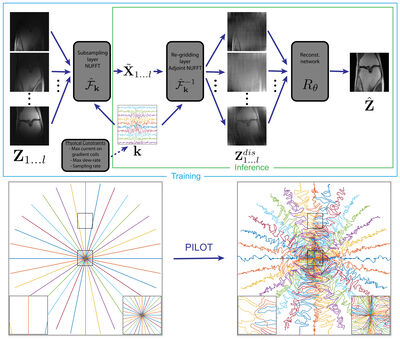 PILOT: Physics-Informed Learned Optimized Trajectories for Accelerated MRI cover file