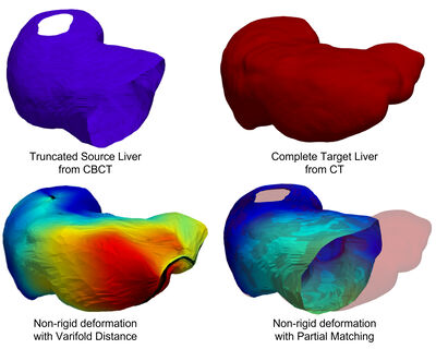 How to Register a Live onto a Liver ? Partial Matching in the Space of Varifolds cover file