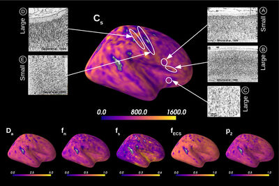 Inverting brain grey matter models with likelihood-free inference: a tool for trustable cytoarchitecture measurements cover file