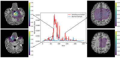 Detecting Outliers with Foreign Patch Interpolation cover file