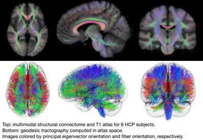 Integrated Construction of Multimodal Atlases with Structural Connectomes in the Space of Riemannian Metrics cover file