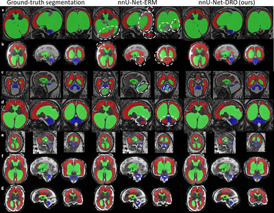 Distributionally Robust Deep Learning using Hardness Weighted Sampling cover file