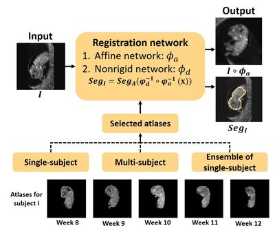 Multi-Atlas Segmentation and Spatial Alignment of the Human Embryo in First Trimester 3D Ultrasound cover file