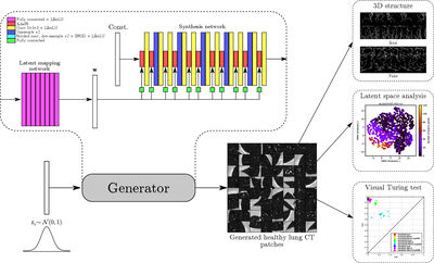 Evaluation of 3D GANs for Lung Tissue Modelling in Pulmonary CT cover file