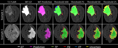 QU-BraTS: MICCAI BraTS 2020 Challenge on Quantifying Uncertainty in Brain Tumor Segmentation – Analysis of Ranking Scores and Benchmarking Results cover file