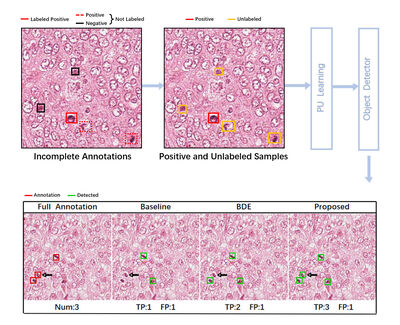 Positive-unlabeled learning for binary and multi-class cell detection in histopathology images with incomplete annotations cover file