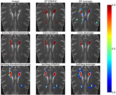 Label fusion and training methods for reliable representation of inter-rater uncertainty cover file