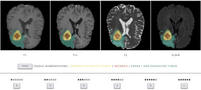 Are we using appropriate segmentation metrics? Identifying correlates of human expert perception for CNN training beyond rolling the DICE coefficient cover file