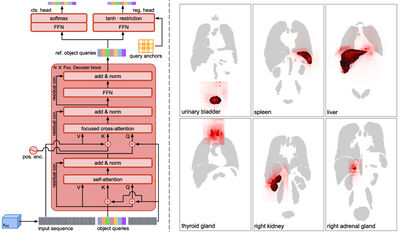 Focused Decoding Enables 3D Anatomical Detection by Transformers cover file