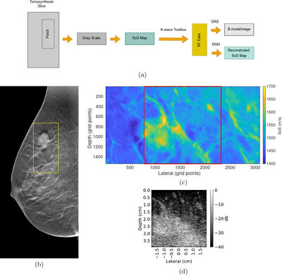 Deep Learning for Ultrasound Speed-of-Sound Reconstruction: Impacts of Training Data Diversity on Stability and Robustness cover file