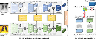 Multi-Scale Feature Fusion using Parallel-Attention Block for COVID-19 Chest X-ray Diagnosis cover file