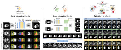 Pathology Synthesis of 3D-Consistent Cardiac MR Images using 2D VAEs and GANs cover file