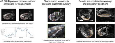 Shape-aware Segmentation of the Placenta in BOLD Fetal MRI Time Series cover file