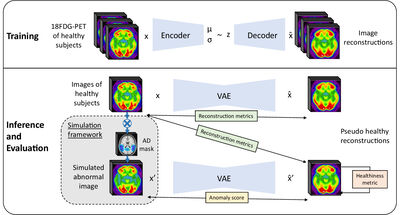 Evaluation of pseudo-healthy image reconstruction for anomaly detection with deep generative models: Application to brain FDG PET cover file