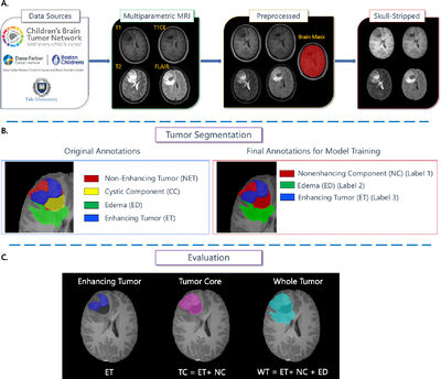 BraTS-PEDs: Results of the Multi-Consortium International Pediatric Brain Tumor Segmentation Challenge 2023 cover file
