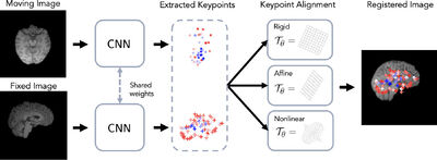 BrainMorph: A Foundational Keypoint Model for Robust and Flexible Brain MRI Registration cover file