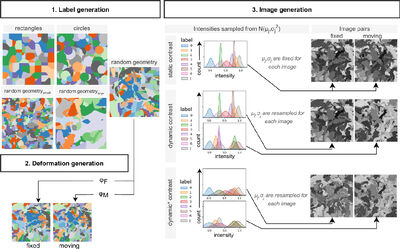 Robust deformable image registration using synthetic data and transfer learning cover file