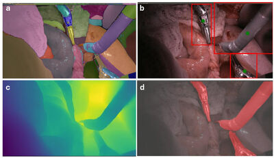 SurgiSR4K: A High‑Resolution Endoscopic Video Dataset for Robotic-Assisted Minimally Invasive Procedures cover file