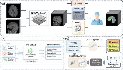 HyKid: An Open MRI Dataset with Expert-Annotated Multi-Structure and Choroid Plexus in Pediatric Hydrocephalus cover file