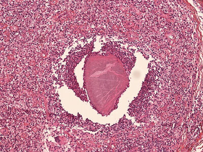 MyData: A Comprehensive Database of Mycetoma Tissue Microscopic Images for Histopathological Analysis cover file