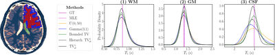 Generalized TV–ℓp Structured Priors for Bayesian T1 Mapping cover file