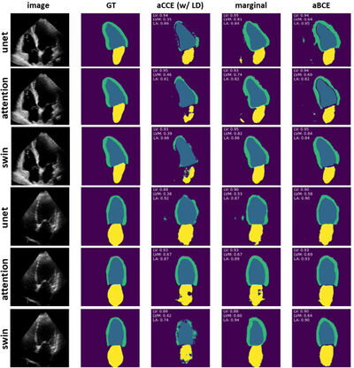 Comparison of Loss Functions for Robust Deep Learning-based Echocardiography Segmentation when Learning with Partially Labelled Data from Multiple Domains cover file
