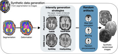 Evaluating Synthetic Data Generation for Domain Generalization in Fetal Brain MRI Segmentation cover file