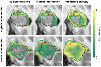 Evaluation of Uncertainty-Aware Multi-Software Ensembles for Hippocampal Segmentation cover file