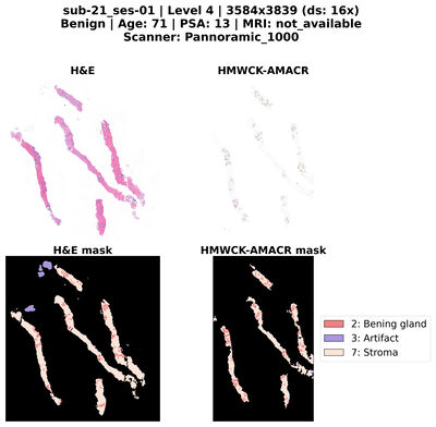 PRECISE: Benchmarking digital pathology with expert-annotated contiguous IHC–H&E serial prostate sections cover file