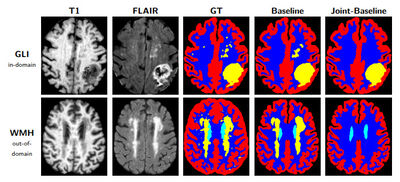 GLI-AL: A Multi-Modal Glioma MRI Label Resource with Unified Anatomy-Lesion Labels cover file