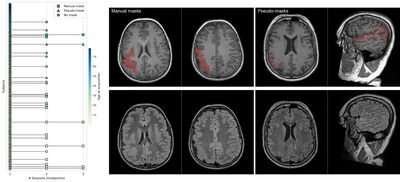 A clinical brain MRI dataset of polymicrogyria in patients suspected of epilepsy cover file