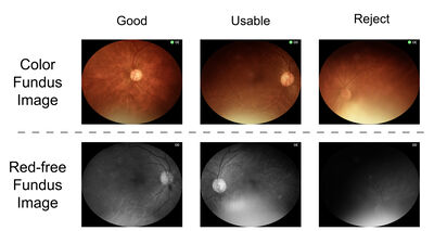 M-FIQ: Mobile Fundus Image Quality Assessment Dataset for Teleophthalmology Screening cover file